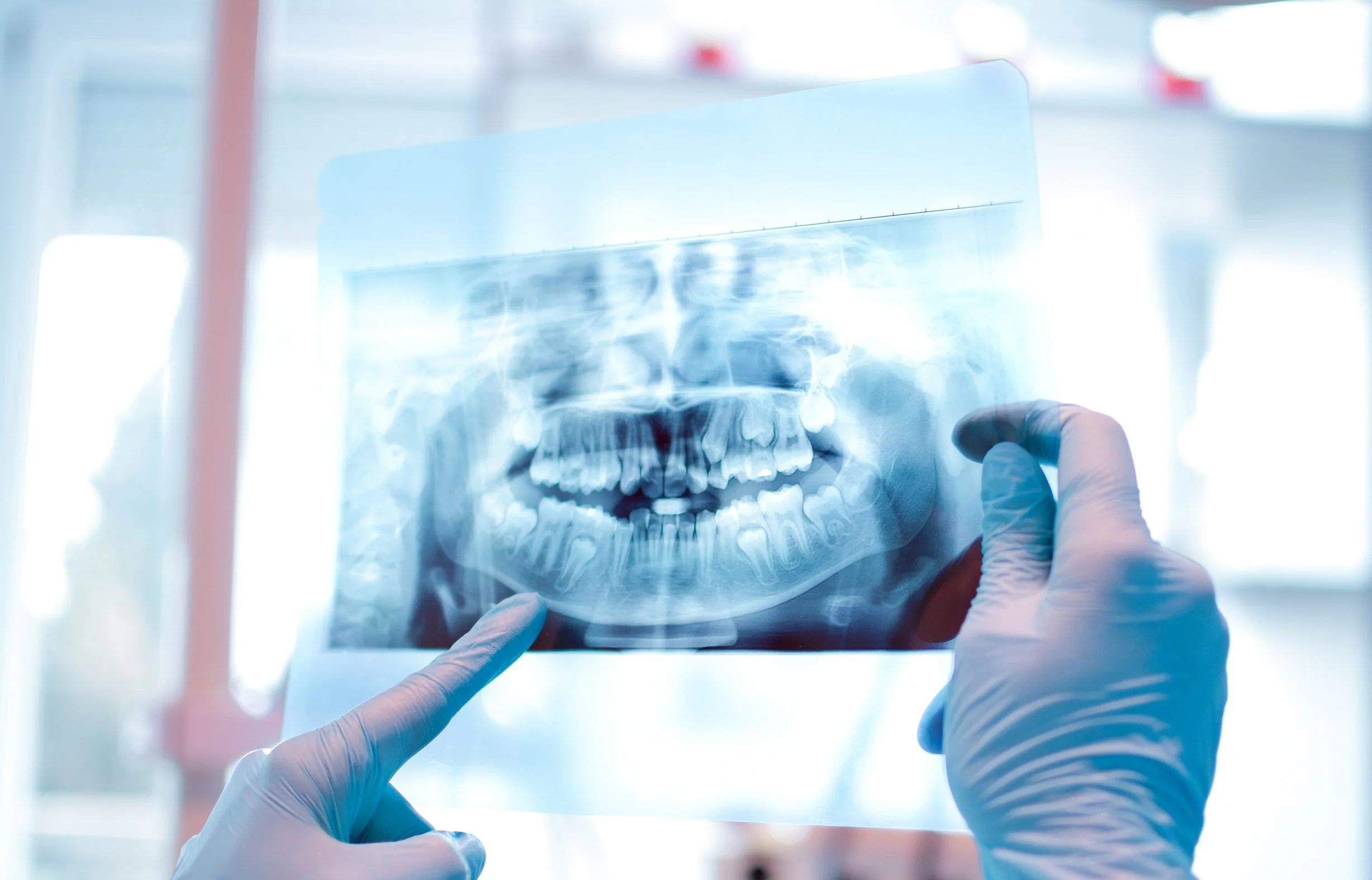 Root Canal Treatments Ryde & Macquarie Park