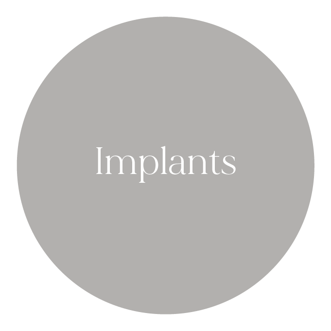 Dental Implants Ryde & Macquarie Park